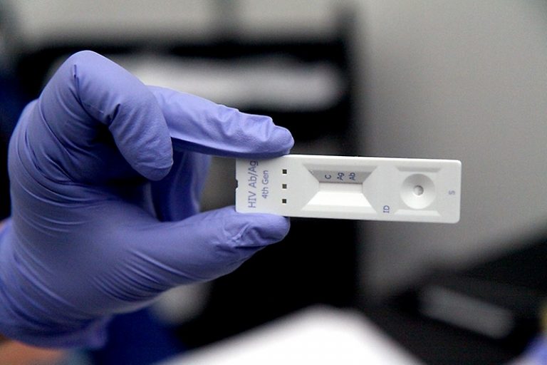 VIH Y Prueba rápida Asociación Atiempo VIH Y Prueba rápida Asociación Atiempo